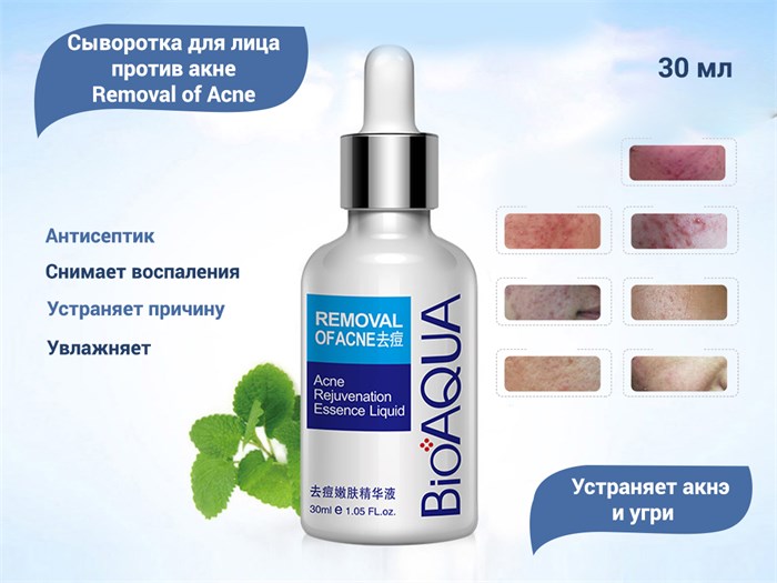 Сыворотка для лица BIOAQUA против акне, 30 мл BQY0726(57621) - фото 554475