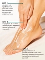 Гель для удаления натоптышей Lamar Professional карбамидный Diabetic foot, 150 мл L0150
