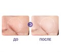 Сыворотка для лица BIOAQUA против веснушек, с ретинолом, 30 мл BQY00751 - фото 554487