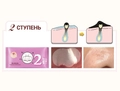 Трехступенчатая маска для лица BIOAQUA Black Head Removal 3-step от черных точек, 3х7 г BQY06708