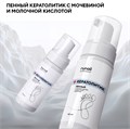 Пенный кератолик RuNail с мочевиной и молочной кислотой, 150 мл №9875 9875 - фото 563356