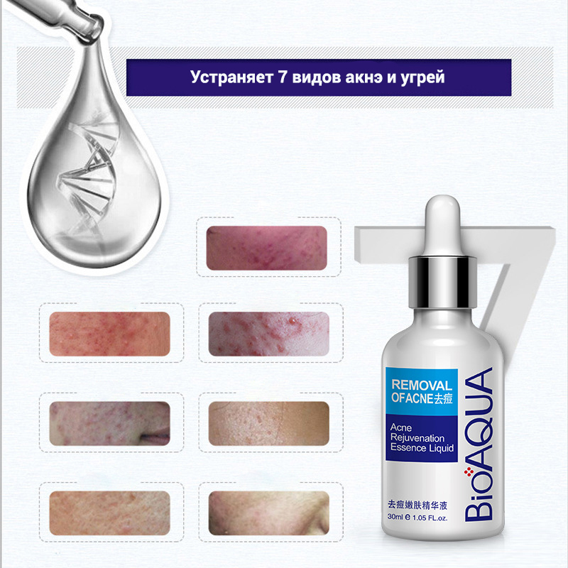 Bioaqua pure. Сыворотка от акне BIOAQUA Pure Skin 30мл.. BIOAQUA, сыворотка для проблемной кожи Pure Skin removal of acne, 30 мл. Сыворотка от акне Pure Skin, 30мл. Сыворотка для лица Ремовал оф акне.